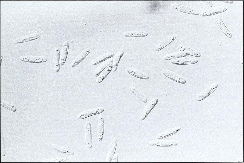 Conidia of Gloeotinia temulenta being produced on the surface of infected seed
